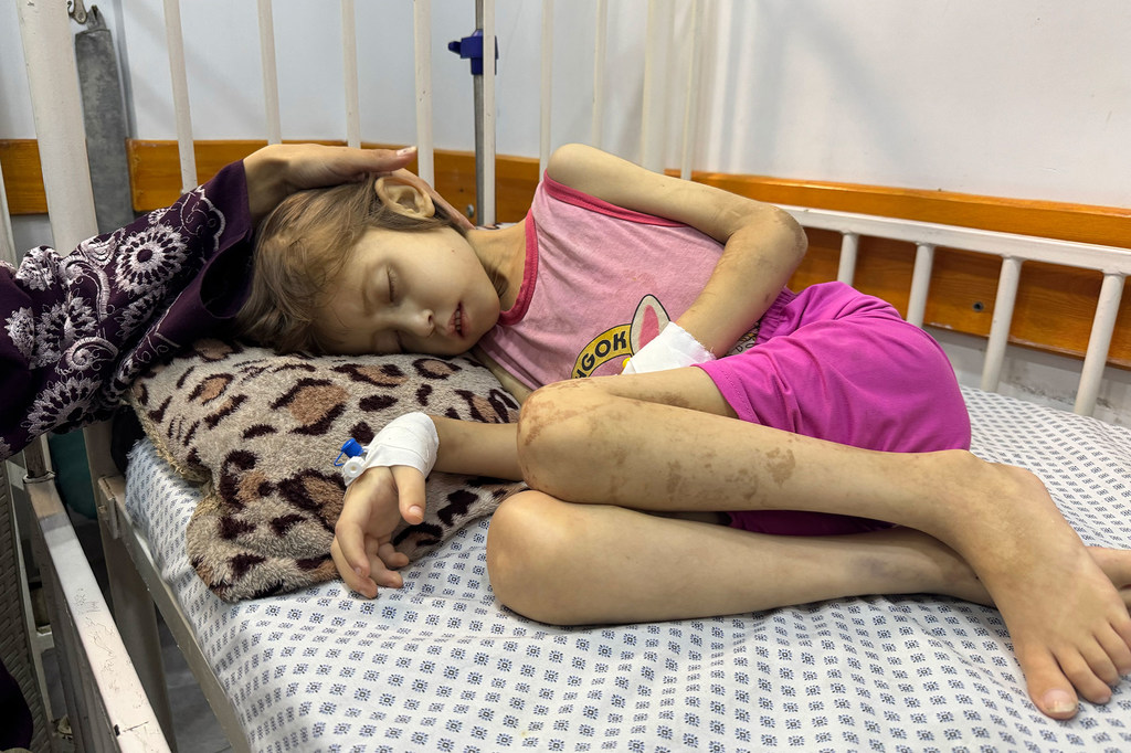 Jana, 9 ans, sur son lit d'hôpital à Gaza-ville, le 25 août 2025, aux côtés de sa mère, Nesma.